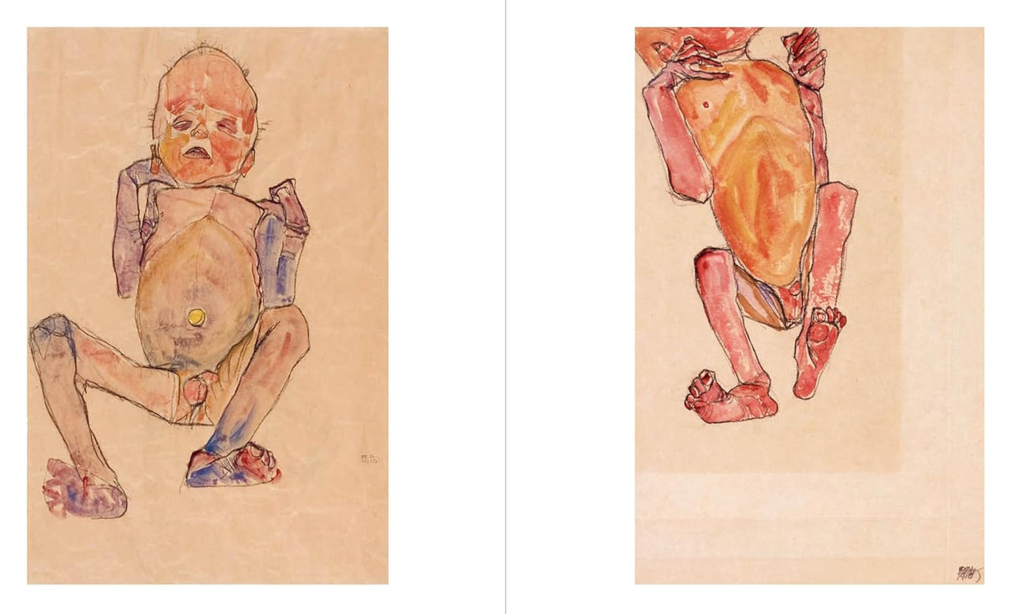 Egon Schiele: Portrait of Dr. Erwin von Graff